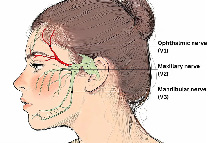 Illustration of the trigeminal nerve's V1 ophthalmic branch highlighted across the forehead and upper-eye area